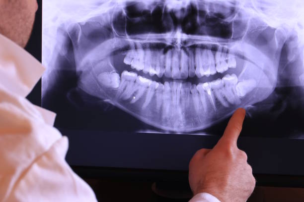 Best Chipped Tooth Repair Near Me  in Alondra Park, CA