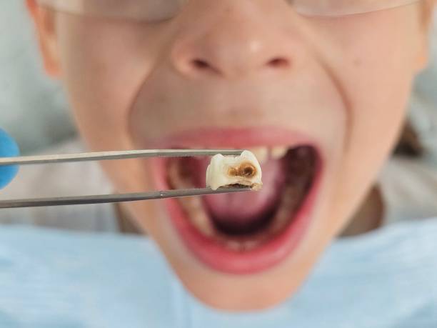 Best Cracked Tooth Emergency Dentist  in Alondra Park, CA